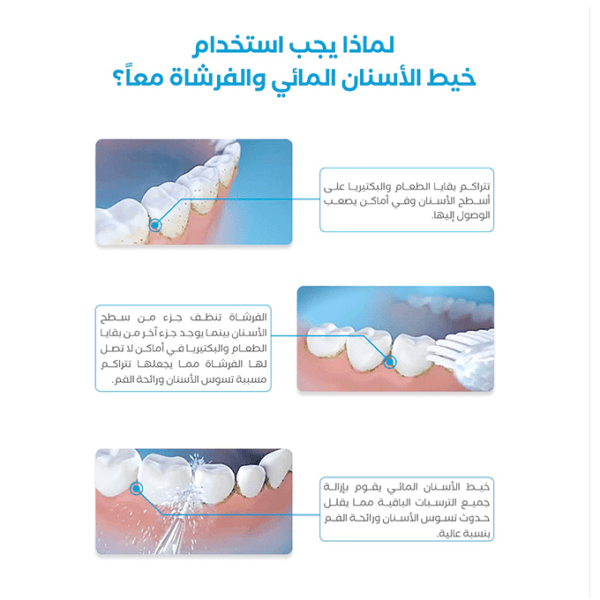 فوهة خيط الأسنان المائي لتنظيف تقويم الأسنان من كيولين - لون أبيض